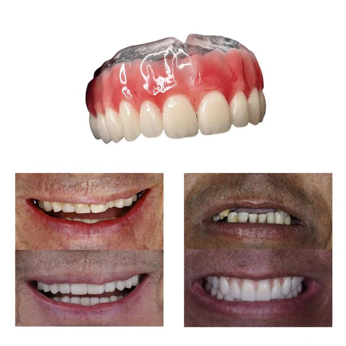 Dentadura de Silicone FIX - Ajustavel e Adaptativa