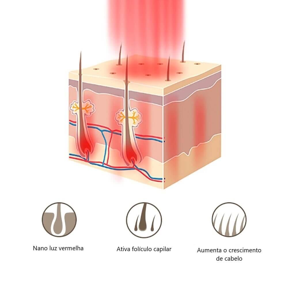Escova a Laser – Terapia para Crescimento Capilar HairRise - Lojas Promorin