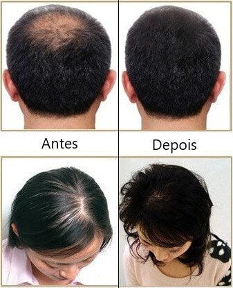 Escova a Laser – Terapia para Crescimento Capilar HairRise - Lojas Promorin